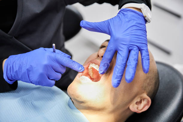Best Dentist for Tooth Abscess  in North Lauderdale, FL